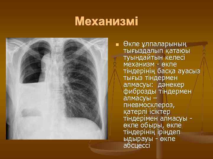 Механизмі n Өкпе ұлпаларының тығыздалып қатаюы туындайтын келесі механизм - өкпе тіндерінің басқа ауасыз