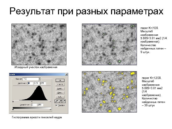 Результат при разных параметрах порог K=7/20. Масштаб изображения 5. 065× 3. 81 мм 2