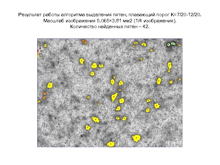 Результат работы алгоритма выделения пятен, плавающий порог K=7/20 -12/20. Масштаб изображения 5. 065× 3.