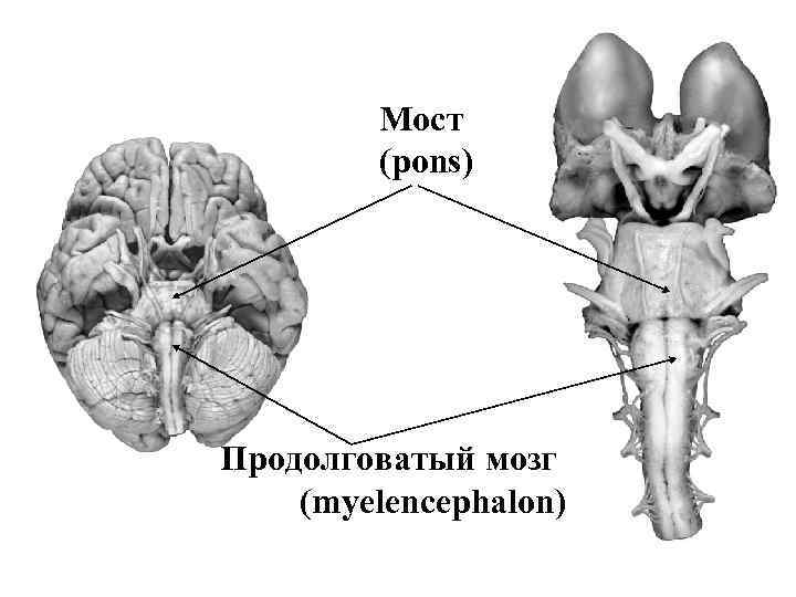 Мост в мозгах. Отделы головного мозга варолиев мост. Продолговатый мозг и варолиев мост. Головной мозг варолиев мост. Задний мозг: продолговатый мозг, варолиев мост..