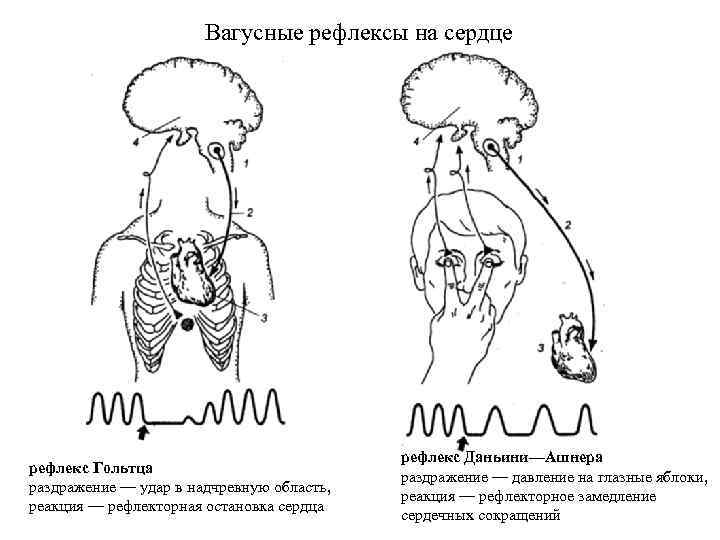 Рефлекс гольца физиология схема