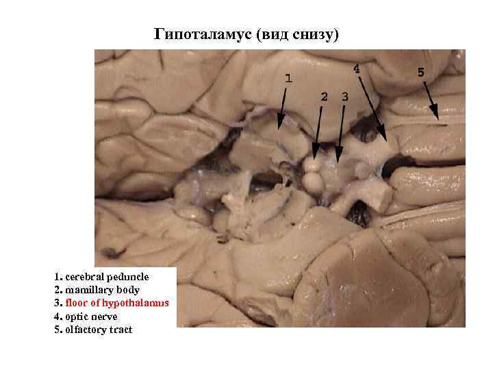 Гипоталамус (вид снизу) 1. cerebral peduncle 2. mamillary body 3. floor of hypothalamus 4.