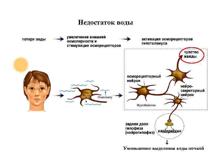 Недостаток воды Уменьшение выделения воды почкой 