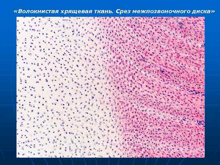  «Волокнистая хрящевая ткань. Срез межпозвоночного диска» 