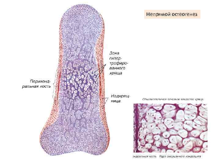 Непрямой остеогенез 