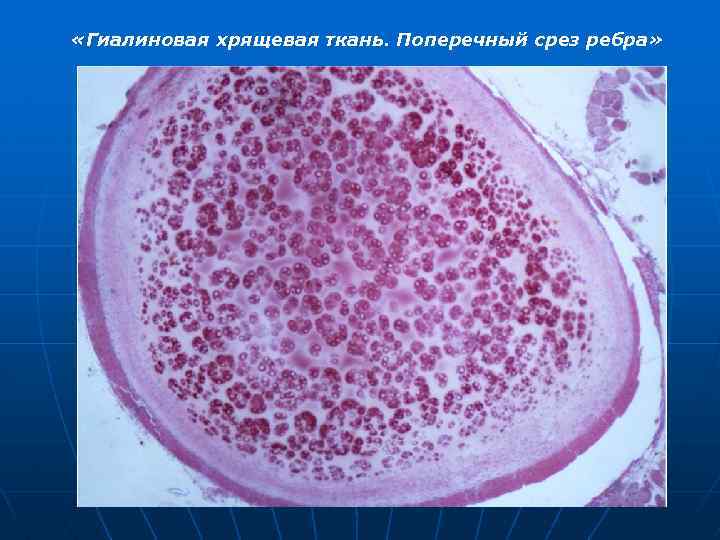  «Гиалиновая хрящевая ткань. Поперечный срез ребра» 