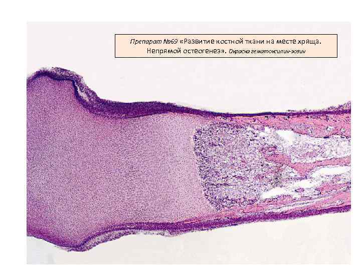 Препарат № 69 «Развитие костной ткани на месте хряща. Непрямой остеогенез» . Окраска гематоксилин-эозин