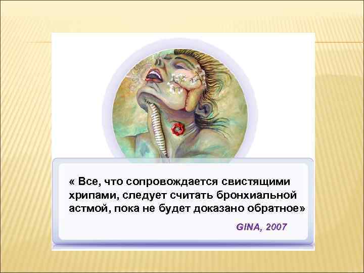  « Все, что сопровождается свистящими хрипами, следует считать бронхиальной астмой, пока не будет