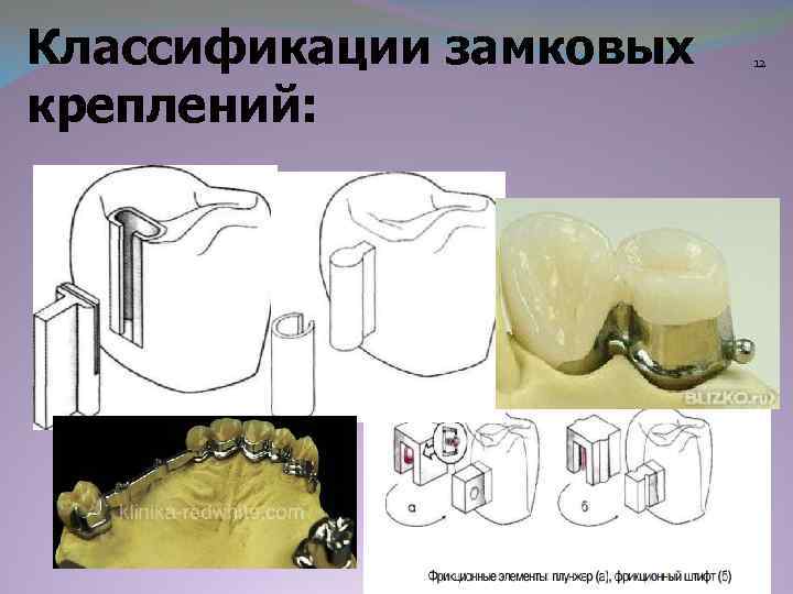 Классификации замковых креплений: 12 