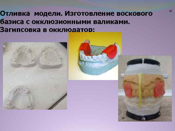 Отливка модели. Изготовление воскового базиса с окклюзионными валиками. Загипсовка в окклюдатор: 16 