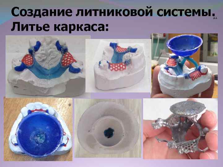 Создание литниковой системы. Литье каркаса: 22 