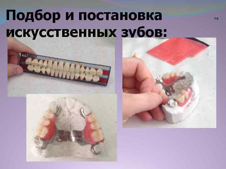 Подбор и постановка искусственных зубов: 24 