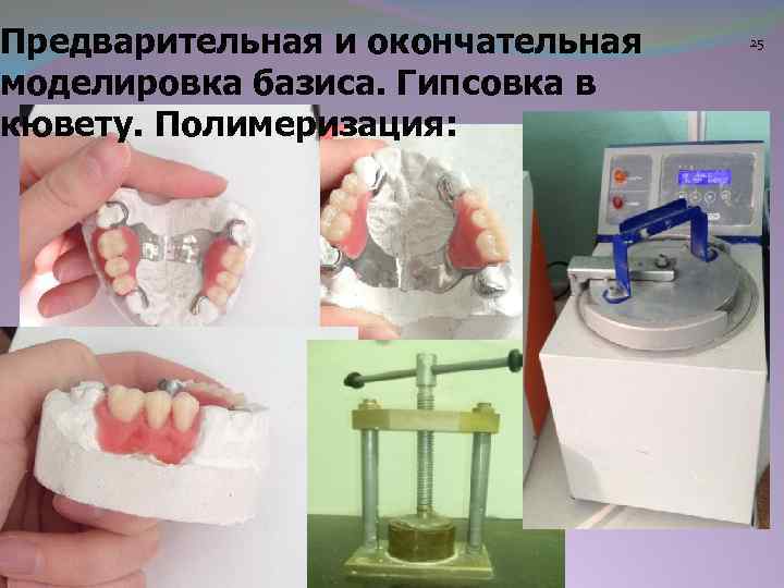 Предварительная и окончательная моделировка базиса. Гипсовка в кювету. Полимеризация: 25 