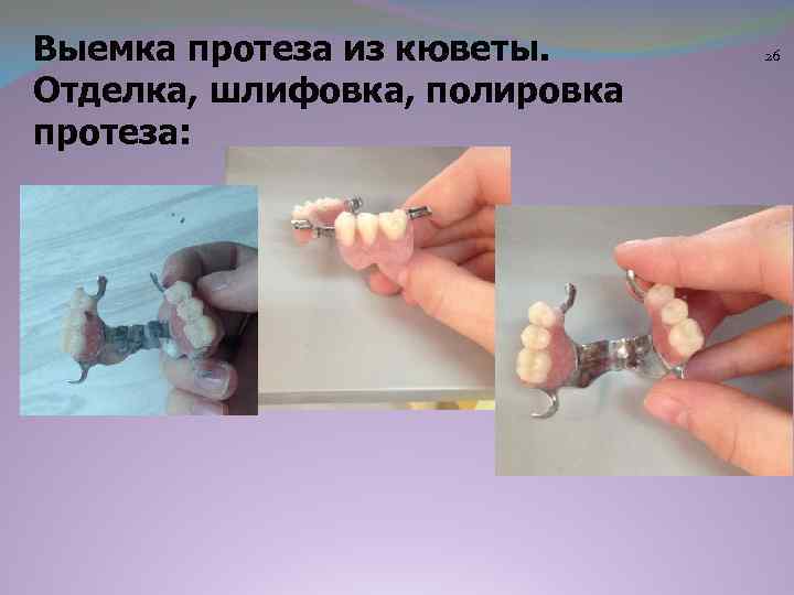 Выемка протеза из кюветы. Отделка, шлифовка, полировка протеза: 26 