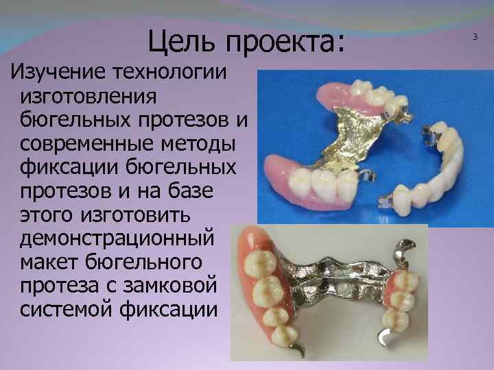 Цель проекта: Изучение технологии изготовления бюгельных протезов и современные методы фиксации бюгельных протезов и