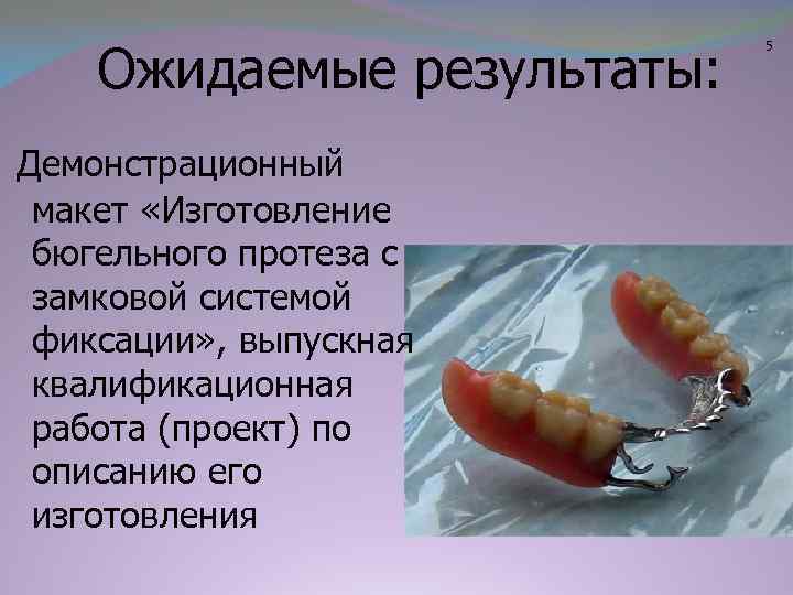 Ожидаемые результаты: Демонстрационный макет «Изготовление бюгельного протеза с замковой системой фиксации» , выпускная квалификационная