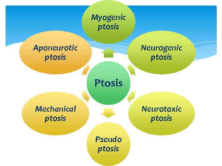 Myogenic ptosis Aponeurotic ptosis Neurogenic ptosis Ptosis Mechanical ptosis Neurotoxic ptosis Pseudo ptosis 