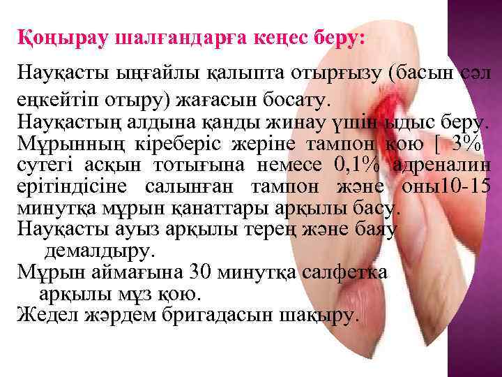 Қоңырау шалғандарға кеңес беру: Науқасты ыңғайлы қалыпта отырғызу (басын сәл еңкейтіп отыру) жағасын босату.