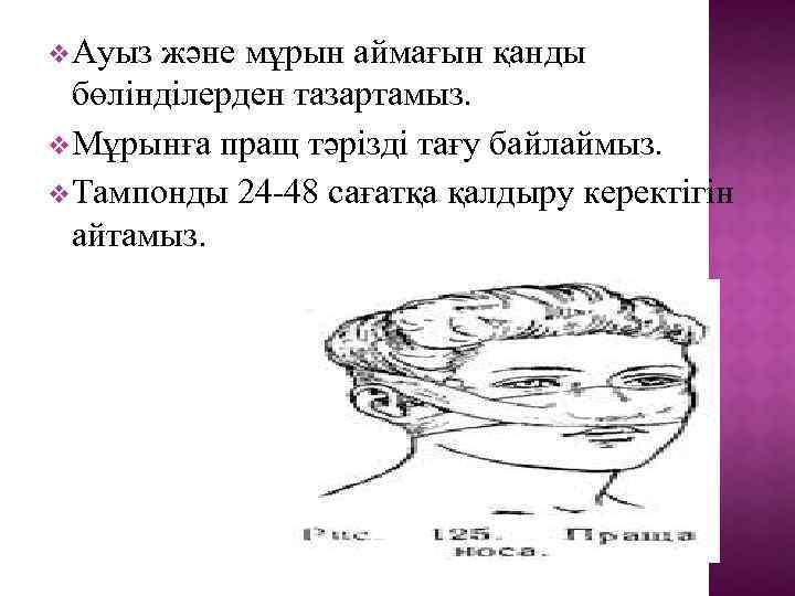 v. Ауыз және мұрын аймағын қанды бөлінділерден тазартамыз. v. Мұрынға пращ тәрізді тағу байлаймыз.