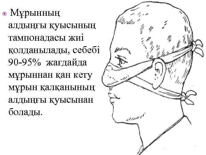  Мұрынның алдыңғы қуысының тампонадасы жиі қолданылады, себебі 90 -95% жағдайда мұрыннан қан кету