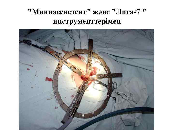 "Миниассистент" және "Лига-7 " инструменттерімен 