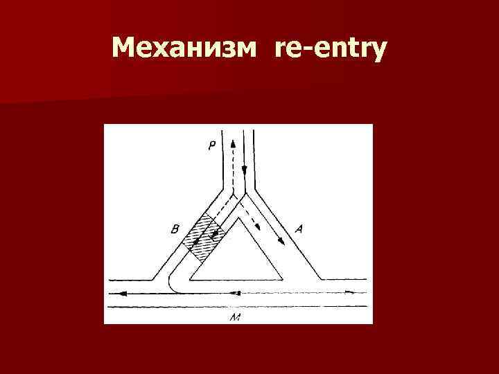 Механизм re-entry 