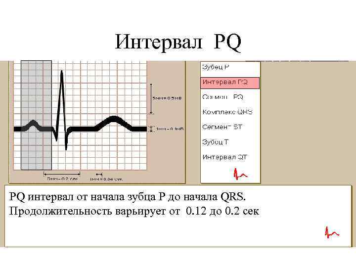 Интервал PQ PQ интервал от начала зубца Р до начала QRS. Продолжительность варьирует от