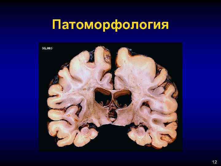 Патоморфология 12 