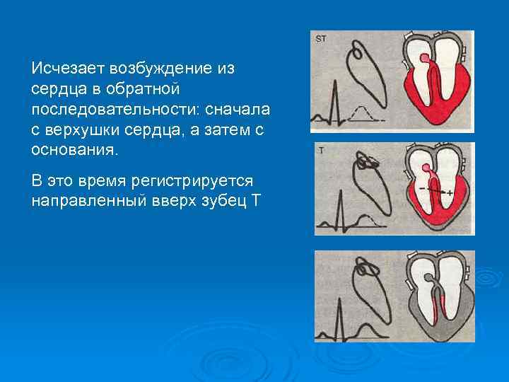 Оба направлены вверх. Возбуждение сердца. Электрический потенциал сердца это. Схема возбуждения сердца. В сердце возбуждения возникает сначала в.