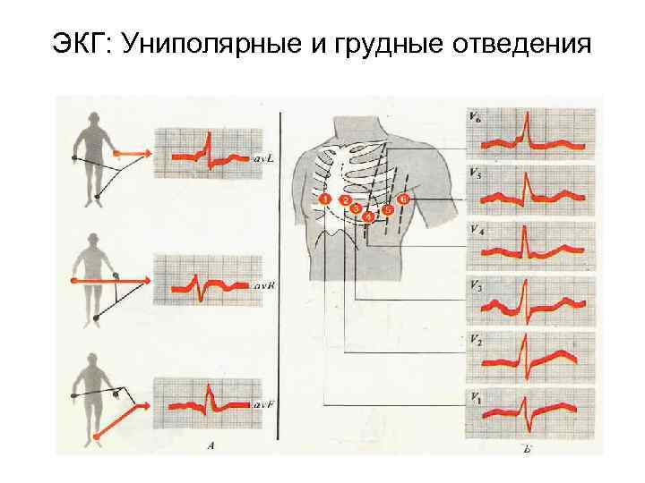 Кардиоджет инструкция по применению схема наложения электродов