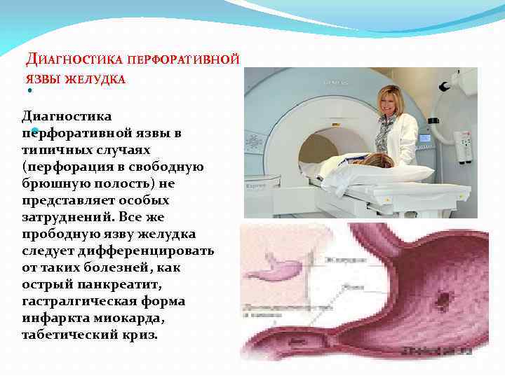 Перфоративная язва желудка карта вызова смп