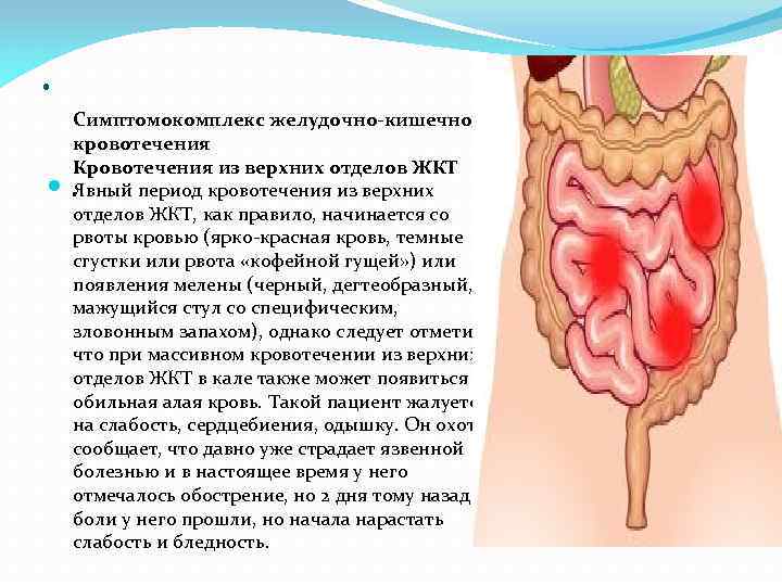 . Симптомокомплекс желудочно-кишечного кровотечения Кровотечения из верхних отделов ЖКТ. Явный период кровотечения из верхних