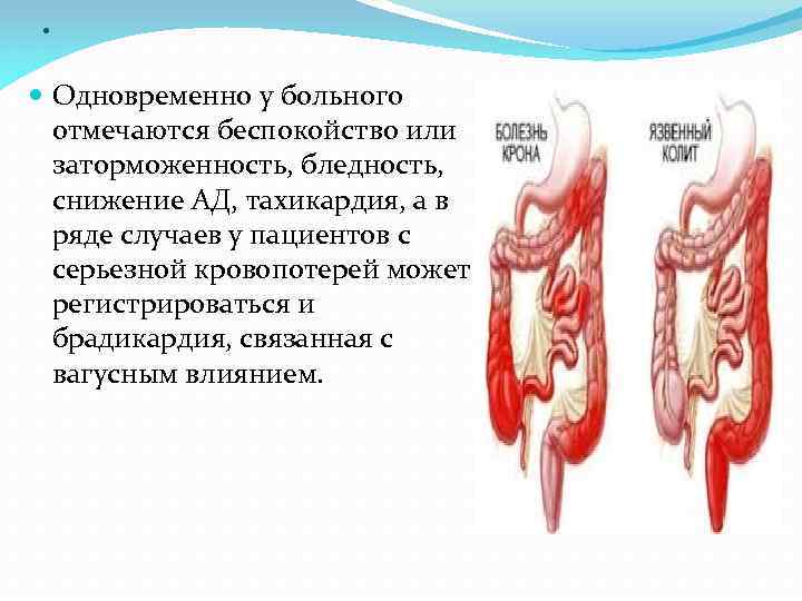 . Одновременно у больного отмечаются беспокойство или заторможенность, бледность, снижение АД, тахикардия, а в