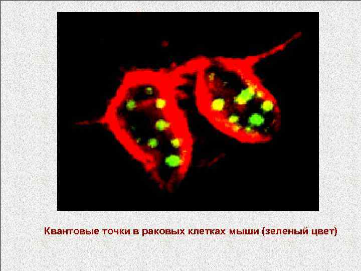 Квантовые точки в раковых клетках мыши (зеленый цвет) 