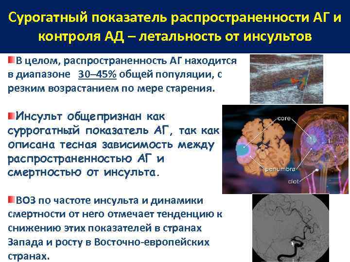 Сурогатный показатель распространенности АГ и контроля АД – летальность от инсультов В целом, распространенность