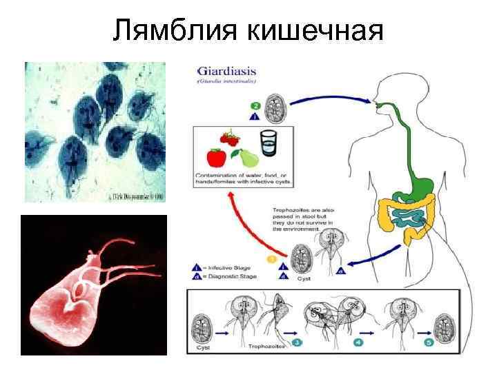 Лямблия кишечная 