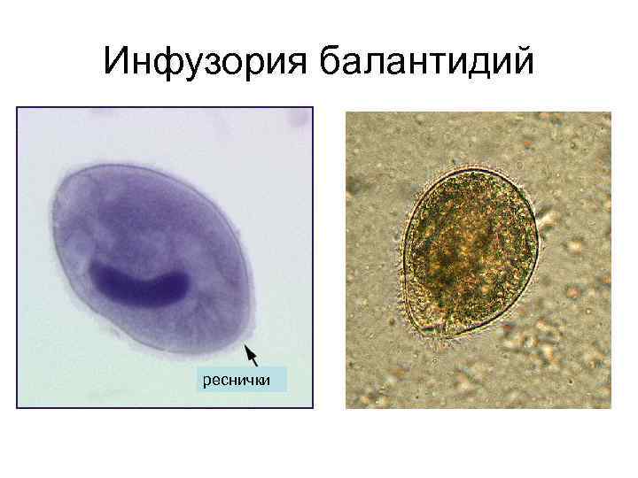 Инфузория балантидий реснички 