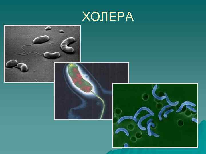 ХОЛЕРА 