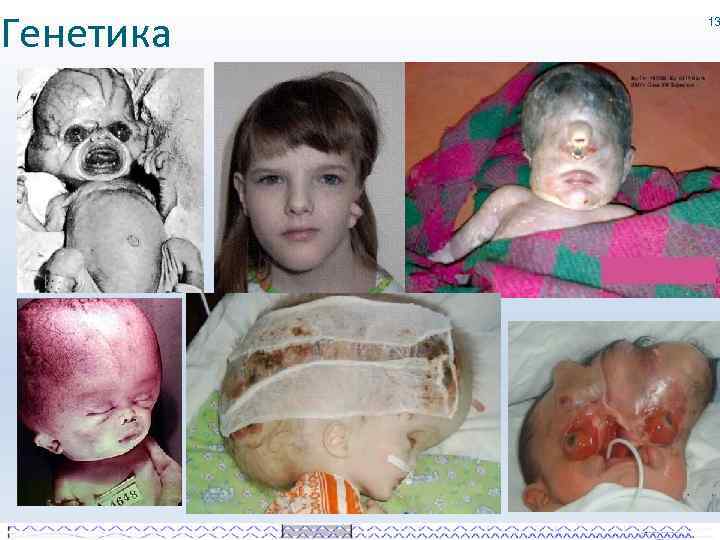 Генетика 13 