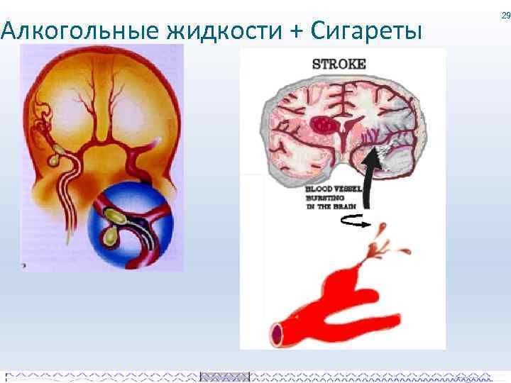 Алкогольные жидкости + Сигареты 29 