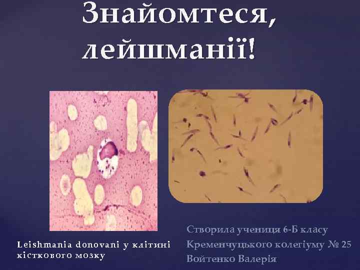 Знайомтеся, лейшманії! { Leishmania donovani у клітині кісткового мозку Створила учениця 6 -Б класу