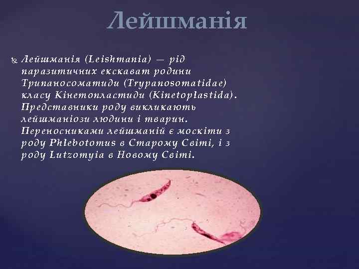 Лейшманія ( Leishmania) — рід паразитичних екскават родини Трипаносоматиди ( Trypanosomatidae) класу Кінетопластиди (