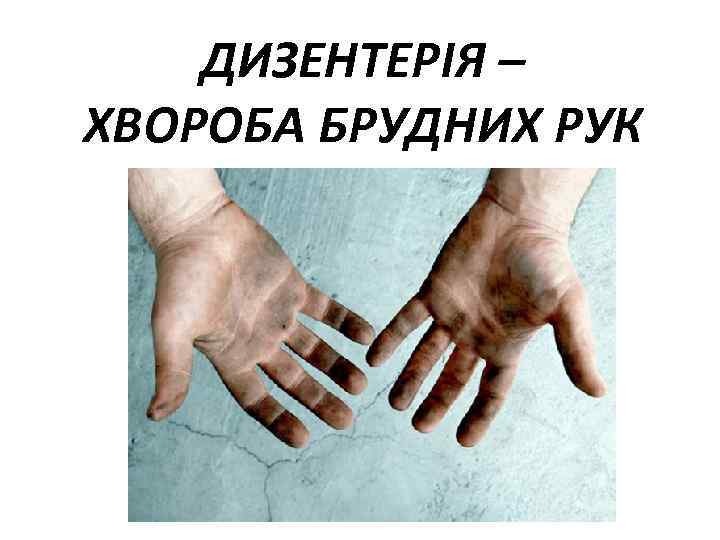 ДИЗЕНТЕРІЯ – ХВОРОБА БРУДНИХ РУК 