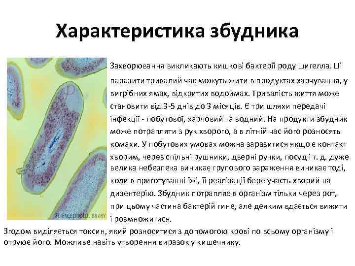 Характеристика збудника Захворювання викликають кишкові бактерії роду шигелла. Ці паразити тривалий час можуть жити