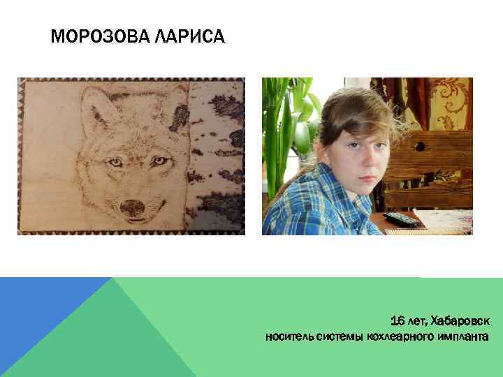 МОРОЗОВА ЛАРИСА 16 лет, Хабаровск носитель системы кохлеарного импланта 