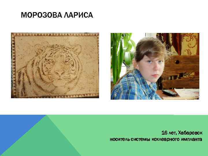 МОРОЗОВА ЛАРИСА 16 лет, Хабаровск носитель системы кохлеарного импланта 