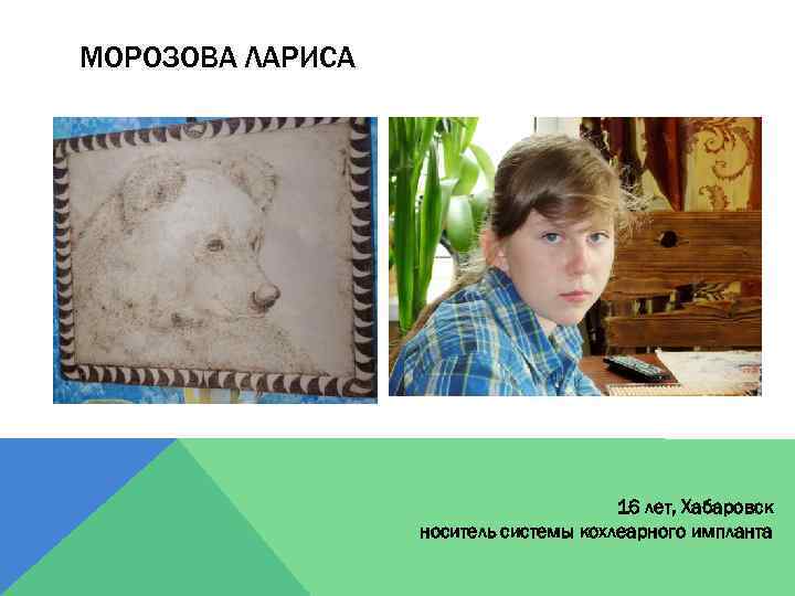 МОРОЗОВА ЛАРИСА 16 лет, Хабаровск носитель системы кохлеарного импланта 