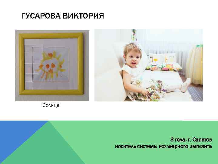 ГУСАРОВА ВИКТОРИЯ Солнце 3 года, г. Саратов носитель системы кохлеарного импланта 
