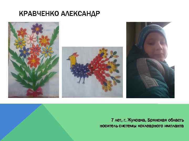 КРАВЧЕНКО АЛЕКСАНДР 7 лет, г. Жуковка, Брянская область носитель системы кохлеарного импланта 