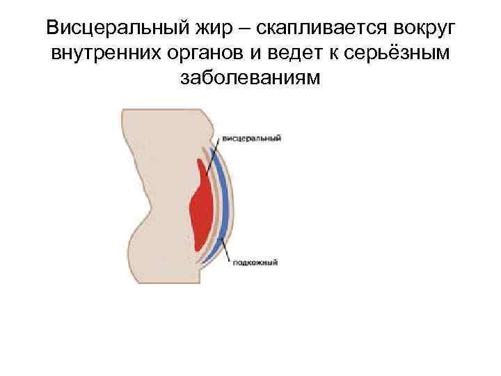 Висцеральный жир – скапливается вокруг внутренних органов и ведет к серьёзным заболеваниям 